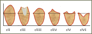 classification Cawood Howell